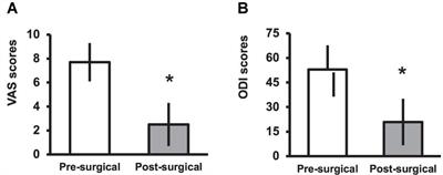 Predictors of Pain Recurrence After Lumbar Facet Joint Injections